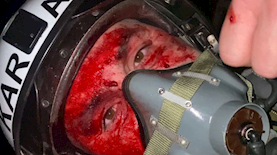 הטייס המדמם, צילום: אינסטגרם